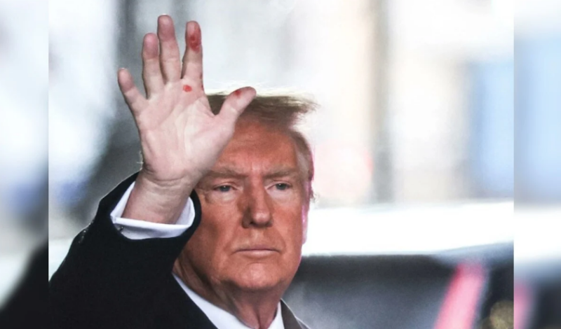 Trump Responds To Question About Image Of His Hand